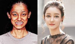 Da đen đúa, răng lởm chởm, cô gái lột xác ngoạn mục xinh như mỹ nhân lai