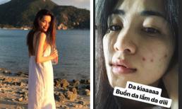 Tin sao Việt 13/4/2018: Hồ Ngọc Hà khoe vòng một căng đầy, Hòa Minzy không ngại chia sẻ mặt mộc nhiều mụn