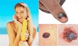 Những quan niệm sai lầm về bệnh ung thư da bạn cần từ bỏ ngay