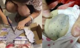 Tò mò cắt áo lót mặc 4 năm ra xem thử, người phụ nữ giật mình kinh hãi