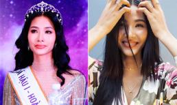 Á hậu Hoàng Thuỳ đeo niềng răng, chuẩn bị cho hành trình đến với Miss Universe 2019?