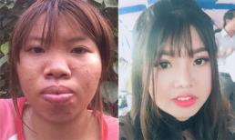 'Thị Nở tái sinh' sau hơn một năm dao kéo: Giờ không chỉ xinh mà còn lên chức bà chủ 