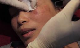 Hành trình làm đẹp từ Đức về Việt Nam của chị Lan tại Thẩm mỹ Hồng Kông 51 Hàng Gà