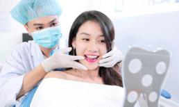 Đẹp toàn diện nhờ bọc răng sứ tại Nha Khoa Kim
