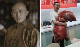 'Hoàng Thượng' Nhiếp Viễn gầy đi trông thấy, dở khóc dở cười vì biệt danh 'chân giò heo' sau 'Diên Hi công lược'