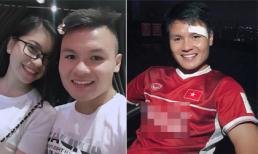 Bị rách mắt ứa máu sau trận thắng Olympic Syria, Quang Hải tiết lộ tình hình sức khỏe hiện tại 