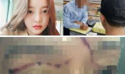 'Búp bê xứ Hàn' Goo Hara bị tung bằng chứng cho thấy đã hành hung bạn trai một cách kinh dị