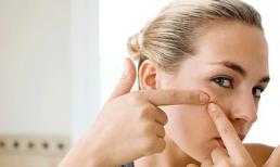 Nặn mụn không thôi có thật sự hiệu quả?