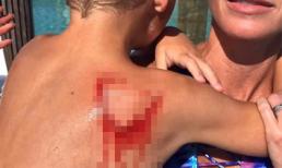 Trải nghiệm bơi cùng cá mập khi đi nghỉ mát cùng gia đình ở Bahamas, cậu bé 8 tuổi bị tấn công