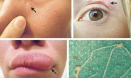 7 ca bệnh gây chấn động nhất năm 2018 nghe chừng tưởng như chỉ có trong phim kinh dị