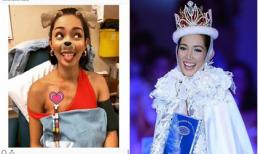 Hoa hậu Quốc tế 2013 suy thận nặng vì liên tục uống 'thần dược' của dân tập gym