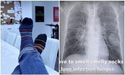 Thường xuyên ngửi tất của mình, người đàn ông phải nhập viện vì nhiễm trùng phổi nặng