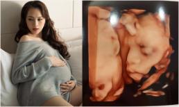 Ngọc Thạch úp mở giới tính em bé thứ 2 và 'hẹn 3 năm nữa lại làm tiếp'