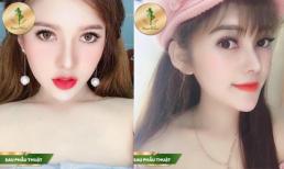 Cơn sốt nâng mũi Sform tại TMV Sài Gòn Venus