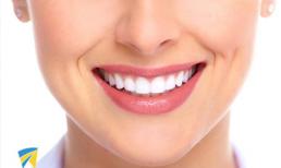 Tẩy trắng răng đón tết, nên hay không?