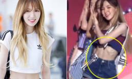 'Vắt thịt, bóp bụng' giảm cân, sao Hàn khiến fans tá hỏa khi xuất hiện với ngoại hình 'trơ xương'