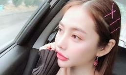 Linh Chi đáp trả khi bị chê 'mồm giống mỏ vịt, phẫu thuật bị lỗi'