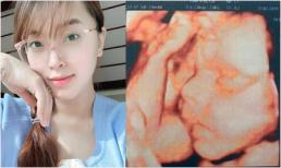 Hải Băng khoe ảnh siêu âm con thứ 3 và tiết lộ luôn giới tính nhóc tì