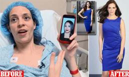 Hai người phụ nữ chi 1 tỷ đồng để dao kéo giống Công nương Meghan Markle và cái kết