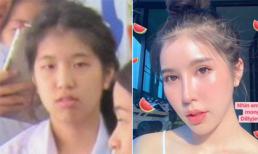 Cô gái 'lột xác' kinh ngạc hậu 'dao kéo', dân mạng lại lo hộ cho giai đoạn sinh con và khi về già