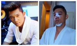 Ở tuổi 37, Lương Bằng Quang gây sốc khi đập toàn bộ mặt đi xây lại