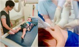 Con trai út Lý Hải - Minh Hà bị ngã chấn thương tay phải nhập viện bó bột