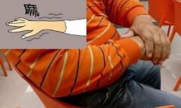 Tay bị tê - 1 trong 4 dấu hiệu cảnh báo bệnh đột quỵ