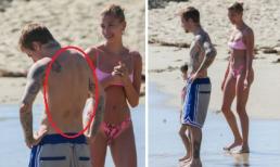 Justin Bieber lộ nhiều vết thâm đỏ kinh hoàng trên lưng khi xuống biển với bà xã nóng bỏng 