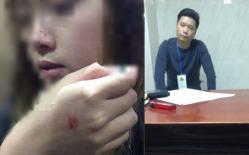 Bộ Công an vào cuộc điều tra lại vụ kẻ sàm sỡ nữ sinh trong thang máy chỉ bị phạt 200.000 đồng