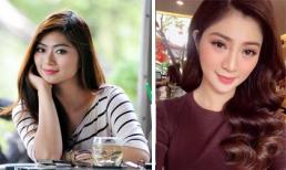 Diễn viên Thanh Trúc nói gì khi bị đồn độn cằm