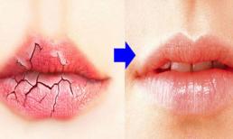 Không phải son dưỡng môi, đây mới là cách dưỡng môi khô, nứt nẻ tốt nhất