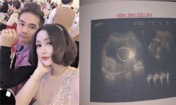 Khánh Đơn tiết lộ vợ mang thai con gái, thai nhi to chèn vào tử cung khiến Huỳnh Như chảy mảu