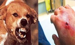 Mắc bệnh dại tử vong 100%, 4 bước cần làm ngay khi bị chó cắn