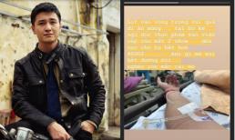 Huỳnh Anh nhập viện cấp cứu vì bị ngộ độc thực phẩm, mất 2 show phải đền hơn 92 triệu đồng