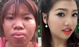 'Thị Nở tái sinh' và 7 ca biến hóa thành hot girl, hot boy gây sốc