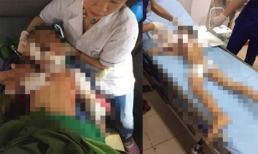Thái Nguyên: Bé trai 7 tuổi bị chó nhà nuôi cắn tử vong thương tâm