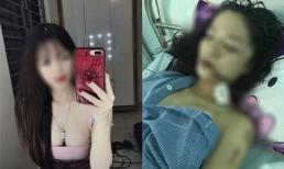 Công an lên tiếng vụ cô gái xinh đẹp bị bạn thân rạch mặt kinh hoàng ở Bắc Ninh