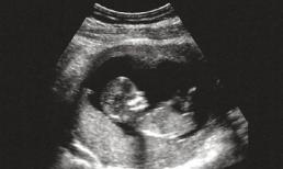 Thai nhi đáng yêu hết nấc, nhảy nhót trong bụng mẹ khiến người xem không ngừng xuýt xoa