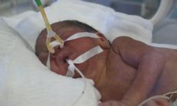 Hình ảnh bé Bình An, thiên thần của người mẹ trẻ mắc ung thư giai đoạn cuối