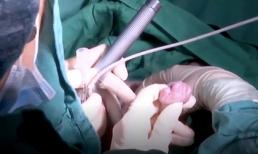 Bé Bình An nắm chặt tay bác sĩ, điều kỳ diệu đến với cả 2 mẹ con