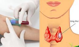 Nếu không muốn mắc ung thư, phụ nữ từ 20-40 tuổi nhất định phải làm 6 xét nghiệm cực quan trọng này