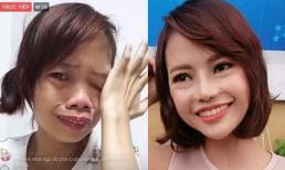 Cô gái ‘xấu xúc phạm người nhìn’ đến mức bị chồng ruồng bỏ sau gần 1 năm giờ ra sao?