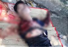 Nhân viên chăm sóc thú nuôi tại khu sinh thái bị hổ cắn đứt 2 cánh tay