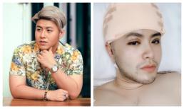 Akira Phan: 'Mỗi lần gặp khán giả đều chê mập đến mức tôi stress cực độ nên quyết định thẩm mĩ'