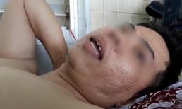 Đình chỉ nhân viên y tế khoan nhầm cẳng chân bệnh nhân