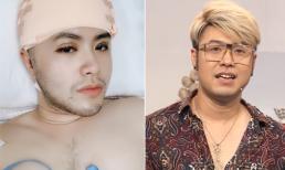 Diện mạo của Akira Phan thay đổi thế nào sau khi phẫu thuật thẩm mỹ?