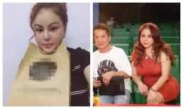 Nhan sắc sau thẩm mĩ của Lê Giang khiến ai nấy bật ngửa