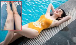 'Quỳnh búp bê' Phương Oanh đăng ảnh đôi chân bầm dập te tua khiến fan kêu trời