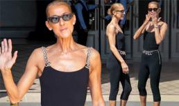 Celine Dion nổi cả mảng gân ở cổ và tay khi được người tình tin đồn hộ tống trên phố