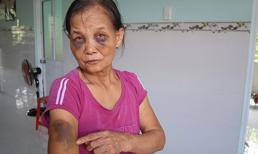 Bị chỉ trích vì đánh mẹ chồng thâm tím mặt mày: Nàng dâu lên tiếng sau khi bỏ đi